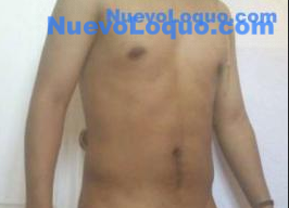 NuevoLoquo0